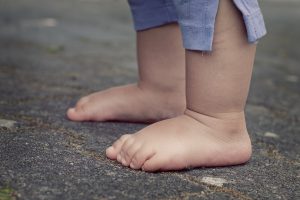【O脚改善のウソ】日本人女性に多い内旋型O脚の治し方 #132
