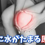 膝に水がたまる原因 〜関節に溜まる滑液の役割〜 #136