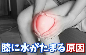 膝に水がたまる原因 〜関節に溜まる滑液の役割〜 #136