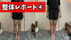 実はO脚は一撃で改善する事ができる【整体レポート④】#221