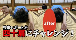 四十肩に整体は効果あるのか？【整体レポート⑤】#255