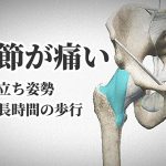 脚の付け根が痛い原因は股関節の捻挫?【スウェイバック】#273