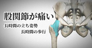 脚の付け根が痛い原因は股関節の捻挫？【スウェイバック】#273