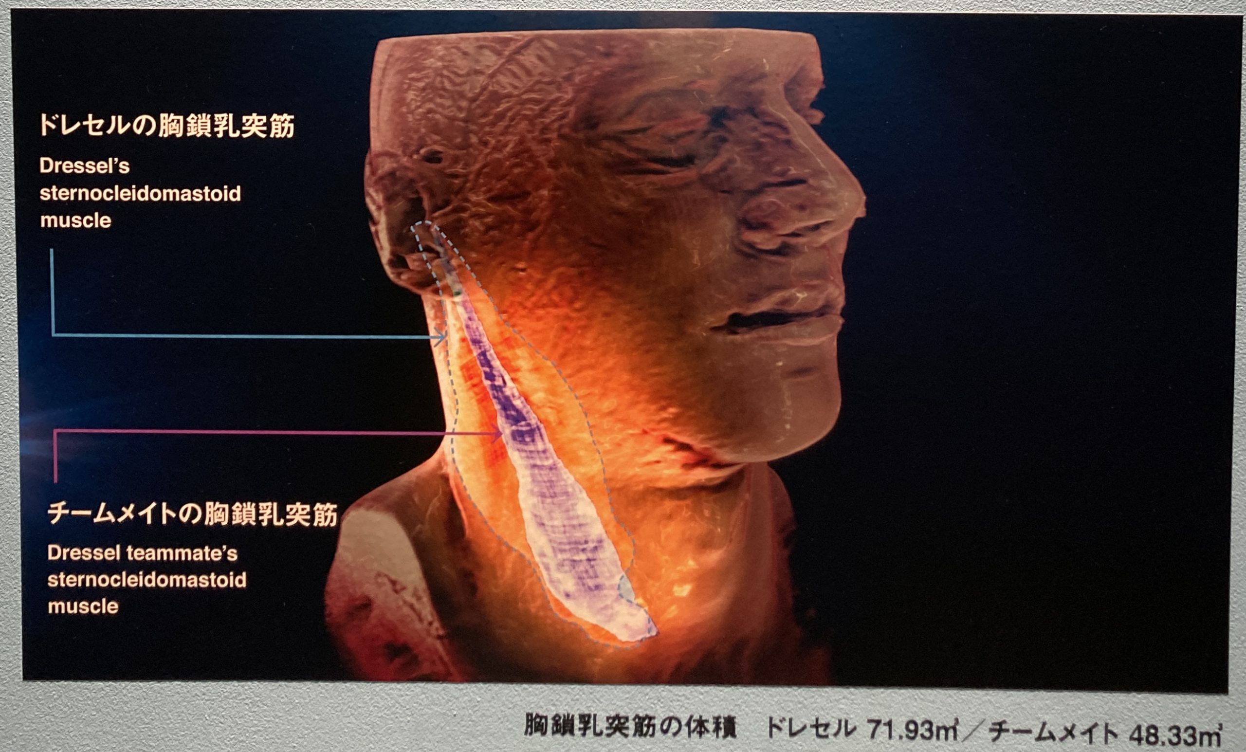 胸鎖乳突筋の秘密